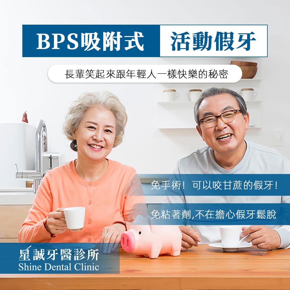 什麼情況需要BPS吸附式活動假牙?一篇帶你了解BPS吸附式活動假牙優點、特色、創新技術、術後服務｜星誠牙醫診所，台北全口重建